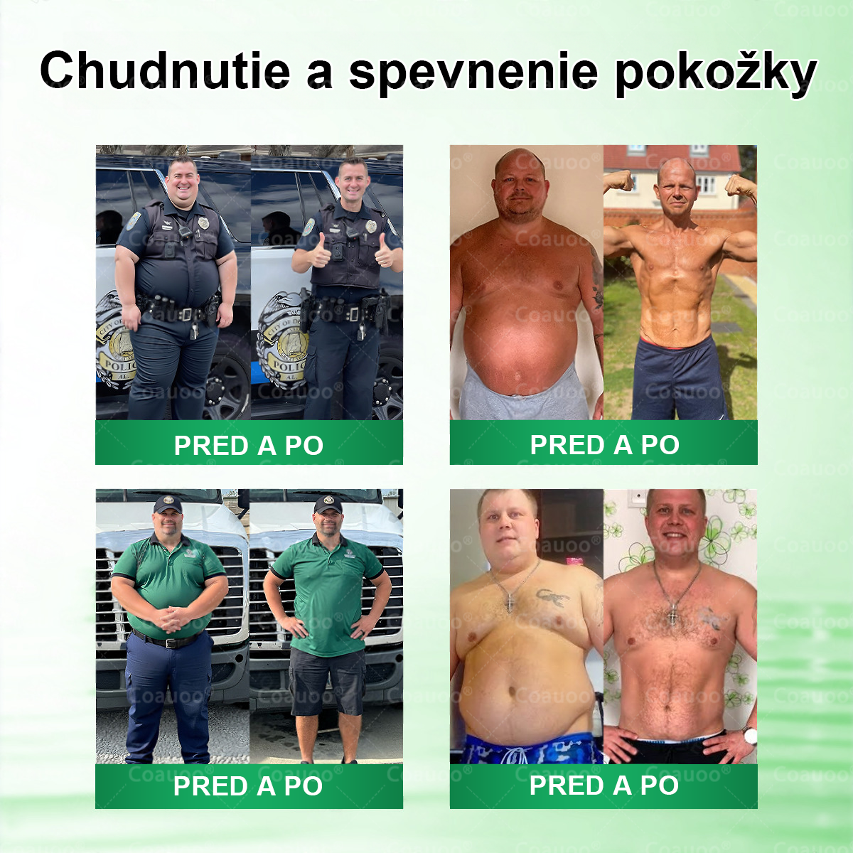 🔥 𝐂𝐨𝐚𝐮𝐨𝐨® Moringa × Berberín × AMPK 10-v-1 Metabolická podpora – nanomikroihlová náplasť (Stačí raz denne, viditeľné výsledky už za 7 dní)  ✅ Na obezitu, ochabnutú pokožku, cukrovku, spánkové apnoe, problémy s kĺbmi a mnohé ďalšie ťažkosti 🔥